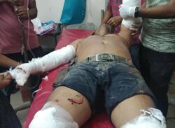 পটুয়াখালীর কলাপাড়ায় শ্রমিক লীগ নেতার কব্জি ছিন্ন