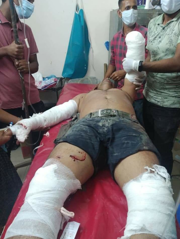 পটুয়াখালীর কলাপাড়ায় শ্রমিক লীগ নেতার কব্জি ছিন্ন