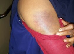 লক্ষ্মীপুরের কমলনগরে কুপ্রস্তাব ও চাঁদা না পেয়ে প্রবাসীর স্ত্রীকে পিটালেন ইউপি সদস্য।