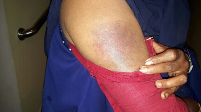 লক্ষ্মীপুরের কমলনগরে কুপ্রস্তাব ও চাঁদা না পেয়ে প্রবাসীর স্ত্রীকে পিটালেন ইউপি সদস্য।