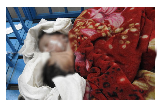 দুই মাথা নিয়ে শিশুর জন্ম:মাগুরায়