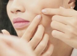 ব্রণ হলে কী করবেন?