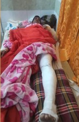 দিনাজপুরে দুর্বৃত্তদের হামলায় কাউন্সিলর প্রার্থী আহত