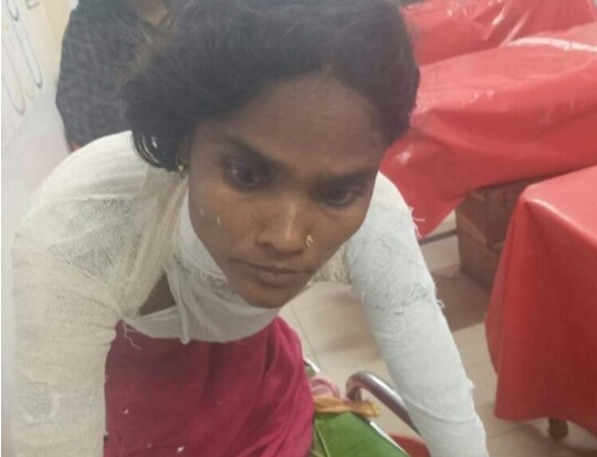 লক্ষ্মীপুরে গৃহবধূ রাশেদা বেগমের গায়ে আগুন দিয়ে হত্যার চেষ্টা