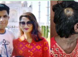 বরিশালে চিকিৎসকের বাসায় শিশু গৃহকর্মী নির্যাতনের ঘটনায় মামলা দায়ের