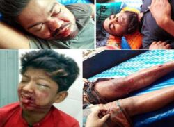 দুই মোটরসাইকেলের মুখোমুখি সংঘর্ষে আহত ৪