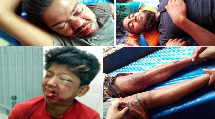 দুই মোটরসাইকেলের মুখোমুখি সংঘর্ষে আহত ৪