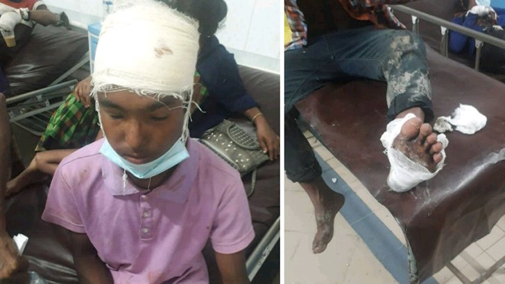 ইমাম-মুয়াজ্জিনকে খাওয়ানো নিয়ে প্রতিপক্ষের হামলায় দুইজন গুলিবিদ্ধ