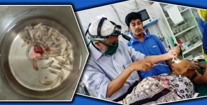 জীবন্ত মানুষের নাক থেকে বের হলো জীবন্ত ৮১ টি পোকা!