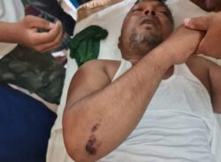 লক্ষ্মীপুরে সংঘর্ষে যুবলীগ নেতা টিপু-বাবর সহ আহত ১৩, সড়কে যানজটে জনদুর্ভোগ।