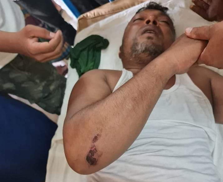 লক্ষ্মীপুরে সংঘর্ষে যুবলীগ নেতা টিপু-বাবর সহ আহত ১৩, সড়কে যানজটে জনদুর্ভোগ।