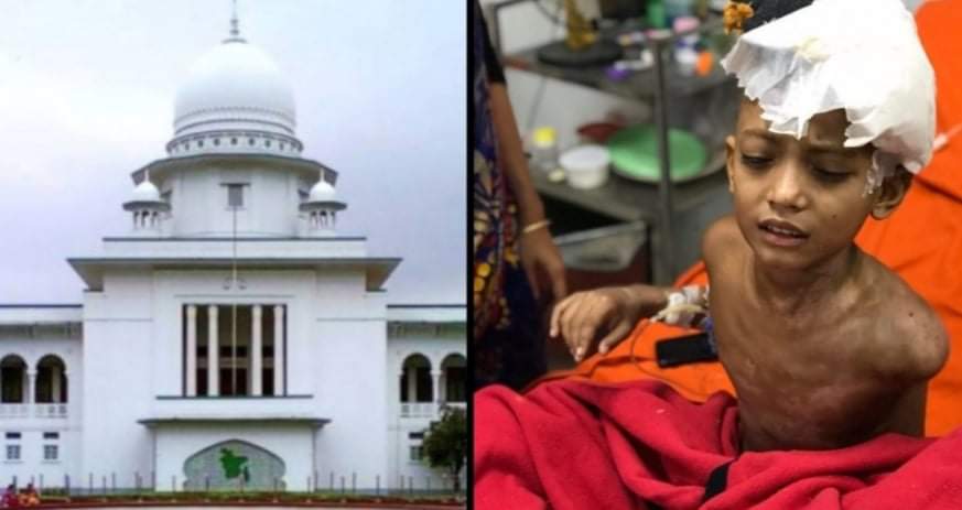লক্ষ্মীপুরের রামগতিতে বিদ্যুৎস্পৃষ্ট আহত শিশু তামিমকে ১০ কোটি টাকা দিতে রুল।