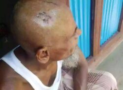 শালিসি বৈঠকে হামলা করে উল্টো মামলা: পুলিশি ভয়ে বাড়িছাড়া তিন পরিবার।