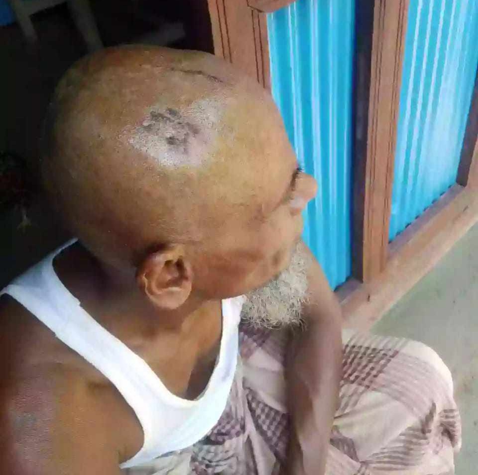 শালিসি বৈঠকে হামলা করে উল্টো মামলা: পুলিশি ভয়ে বাড়িছাড়া তিন পরিবার।