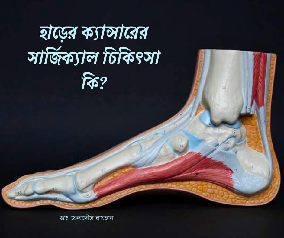 হাঁড়ের ক্যান্সারের চিকিৎসা নির্ভর করে রোগীর বয়স, স্বাস্থ্য, ক্যান্সারের পর্যায়, টিউমারের আকার ও অবস্থানের উপর।