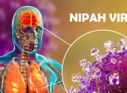 নিপাহ ভাইরাস প্রতিরোধে সচেতনতামূলক কার্যক্রমের নির্দেশ
