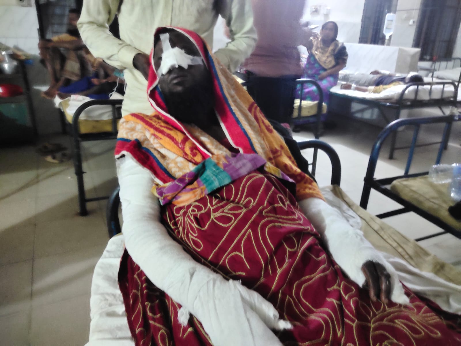 বঙ্গোপসাগরে গ্যাস সিলিন্ডার বিস্ফোরণে ট্রলার ভষ্মিভূত, দুই জেলে দ্বগ্ধ।।