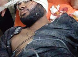 লক্ষ্মীপুরের চন্দ্রগঞ্জে আধিপত্য বিস্তারকে কেন্দ্র করে হামলা, ছাত্রলীগের ৪ কর্মি আহত