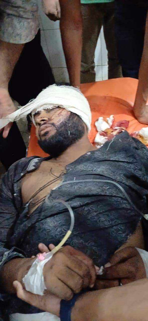 লক্ষ্মীপুরের চন্দ্রগঞ্জে আধিপত্য বিস্তারকে কেন্দ্র করে হামলা, ছাত্রলীগের ৪ কর্মি আহত