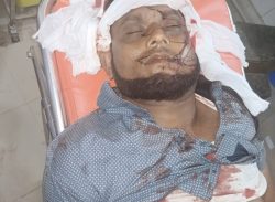 উখিয়ায় ক্যাম্পে রোহিঙ্গা যুবককে কুপিয়ে হত্যা