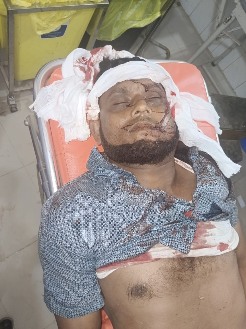 উখিয়ায় ক্যাম্পে রোহিঙ্গা যুবককে কুপিয়ে হত্যা