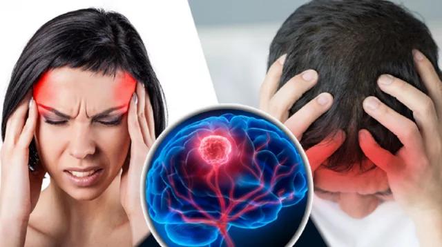 দেশে ব্রেইন টিউমারে বছরে আক্রান্ত ২০ হাজার