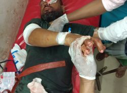 কলাপাড়ায় নির্বাচনী সহিংসতায় প্রতিপক্ষের হামলায় গুরুতর আহত-৪