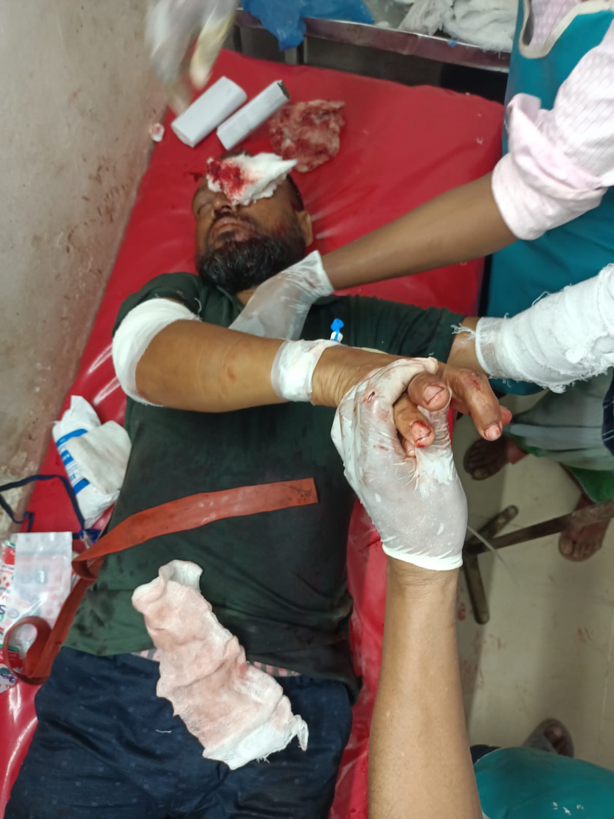 কলাপাড়ায় নির্বাচনী সহিংসতায় প্রতিপক্ষের হামলায় গুরুতর আহত-৪