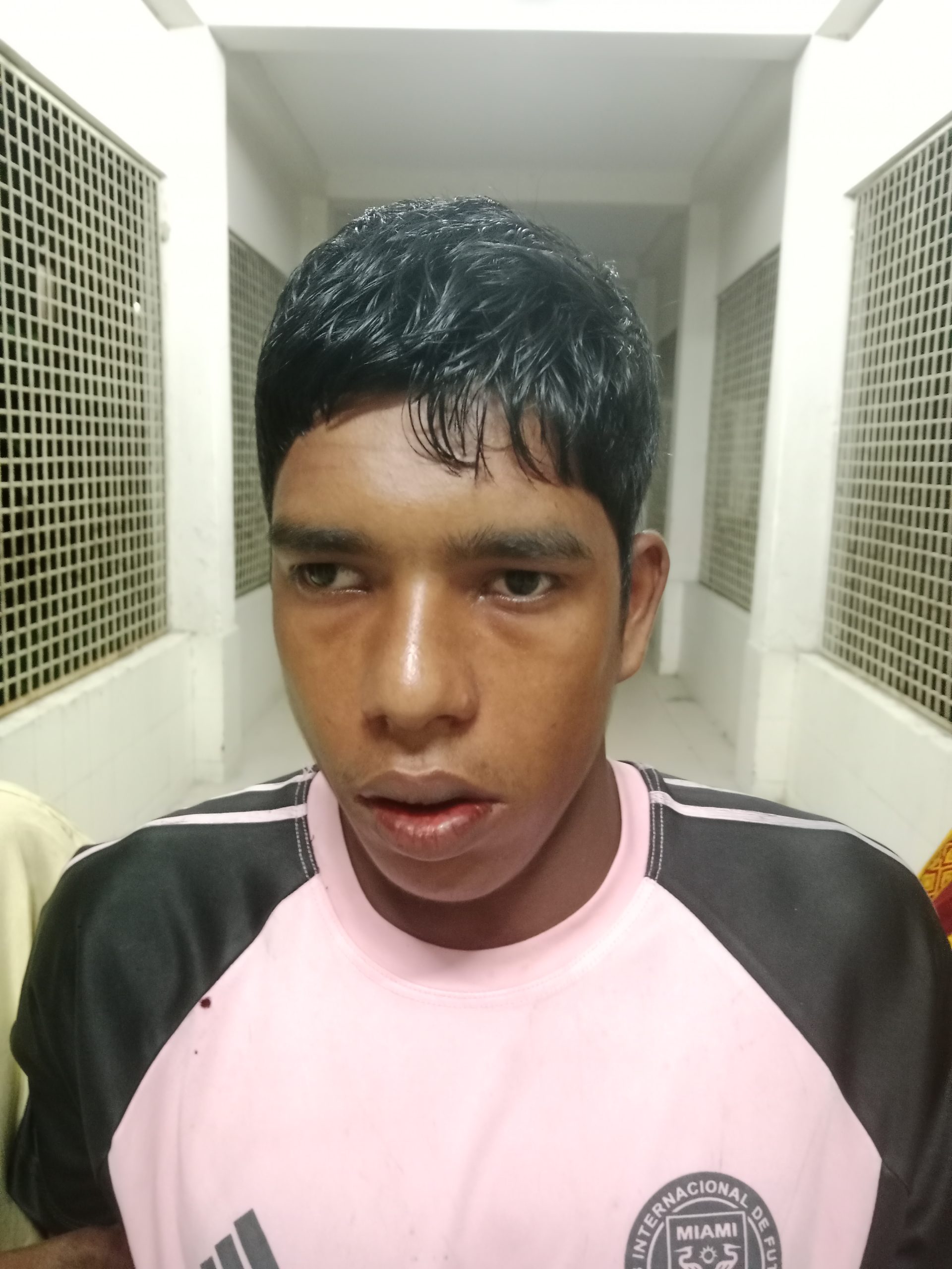 পটুয়াখালীর ছোটবিঘাই বুদ্ধি প্রতিবন্ধীকে মধ্যযুগীয় কায়দায় গাছের সাথে বেধে মারধর। 