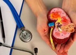 বাংলাদেশিদের কিডনি পাচার, দিল্লির অ্যাপোলো হাসপাতালের চিকিৎসক গ্রেফতার