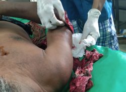 পটুয়াখালীর ডিবুয়াপুরে জমি নিয়ে পূর্ব শত্রুতার প্রতিশোধ নিতে প্রাননাশের হামলা,আহত ৪।