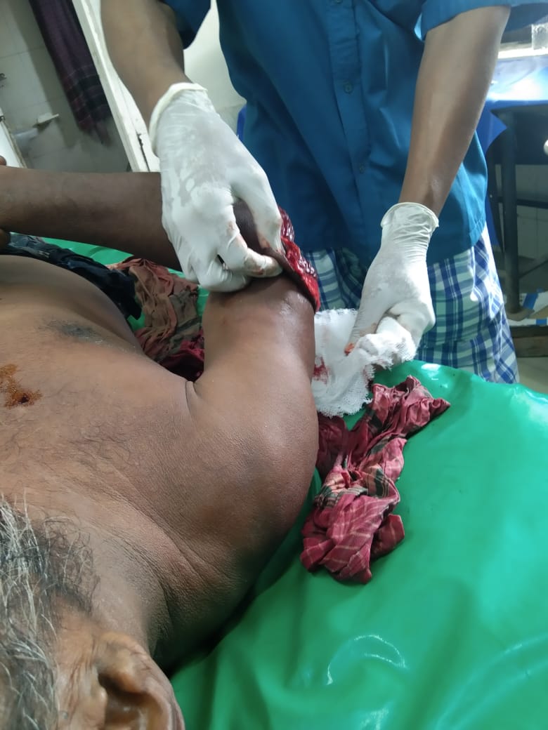 পটুয়াখালীর ডিবুয়াপুরে জমি নিয়ে পূর্ব শত্রুতার প্রতিশোধ নিতে প্রাননাশের হামলা,আহত ৪।