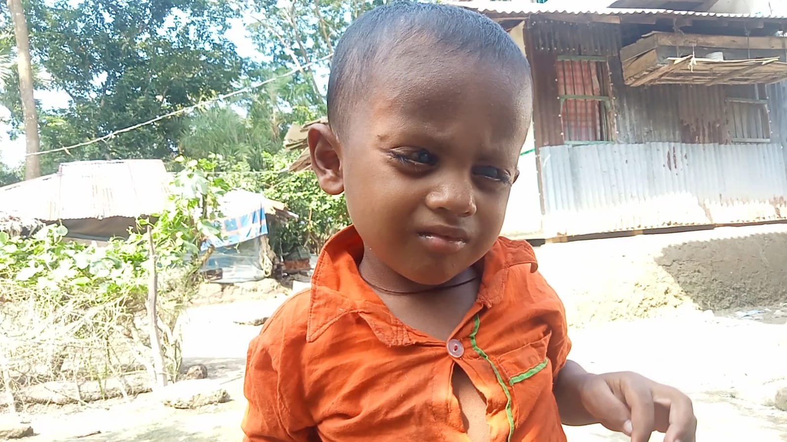 মহিপুরে অর্থের অভাবে অন্ধ হতে বসেছে শিশু তাওহিদ, সাহায্যের আবেদন