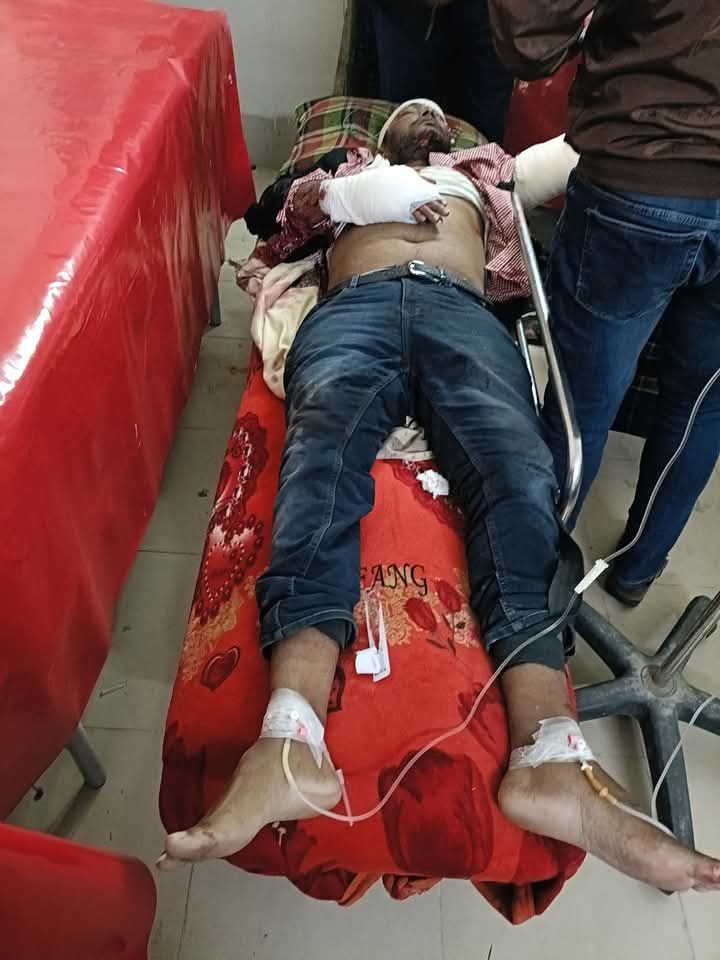 কুয়াকাটায় বাংলাভিশন প্রতিনিধি মিরনকে কুপিয়ে বাসার সামনে ফেলে রেখে গেছে দুর্বৃত্তরা।।