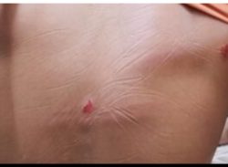 বাগেরহাটের মোল্লাহাটে   মেয়েকে ইভটিজিং করার প্রতিবাদ করায় পিতাকে মারধরের অভিযোগ পাওয়া গেছে।