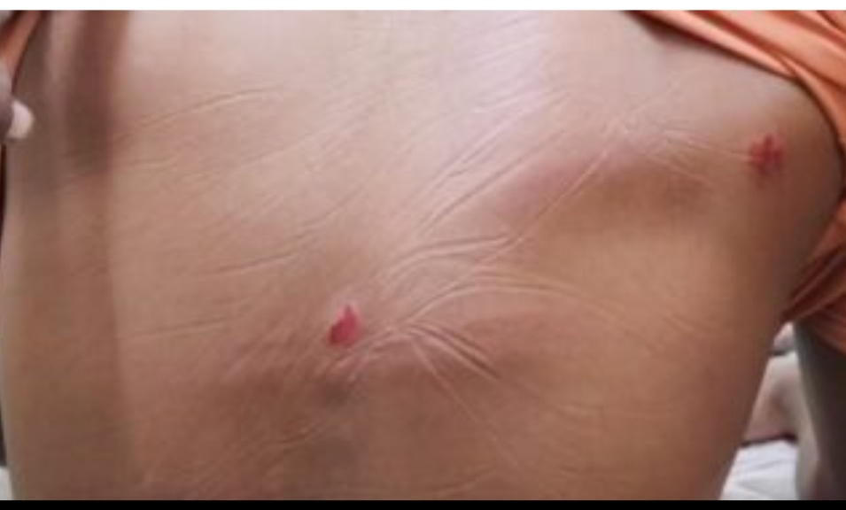 বাগেরহাটের মোল্লাহাটে   মেয়েকে ইভটিজিং করার প্রতিবাদ করায় পিতাকে মারধরের অভিযোগ পাওয়া গেছে।