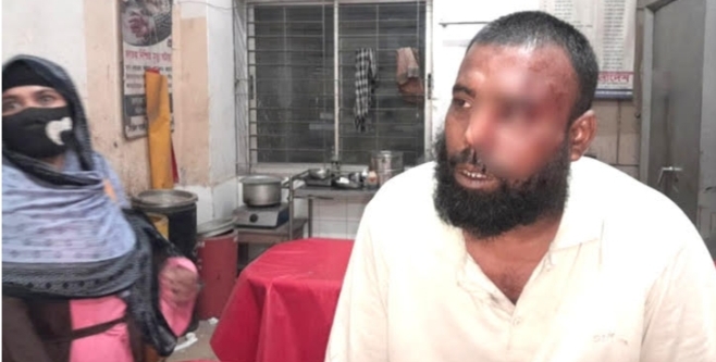 লক্ষ্মীপুরে অসহায় পিতাকে খাবার দেওয়ায় দম্পতির ওপর সন্তানদের হামলা!