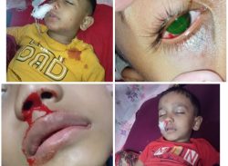 অসুস্থ সন্তানকে বাচাঁতে স্বামীর সর্বোচ্চ অবহেলা সহ্য করছেন।। শেষে বিচারের আশায় আইনের দ্বারস্থ কলাপাড়ার রীনা।।