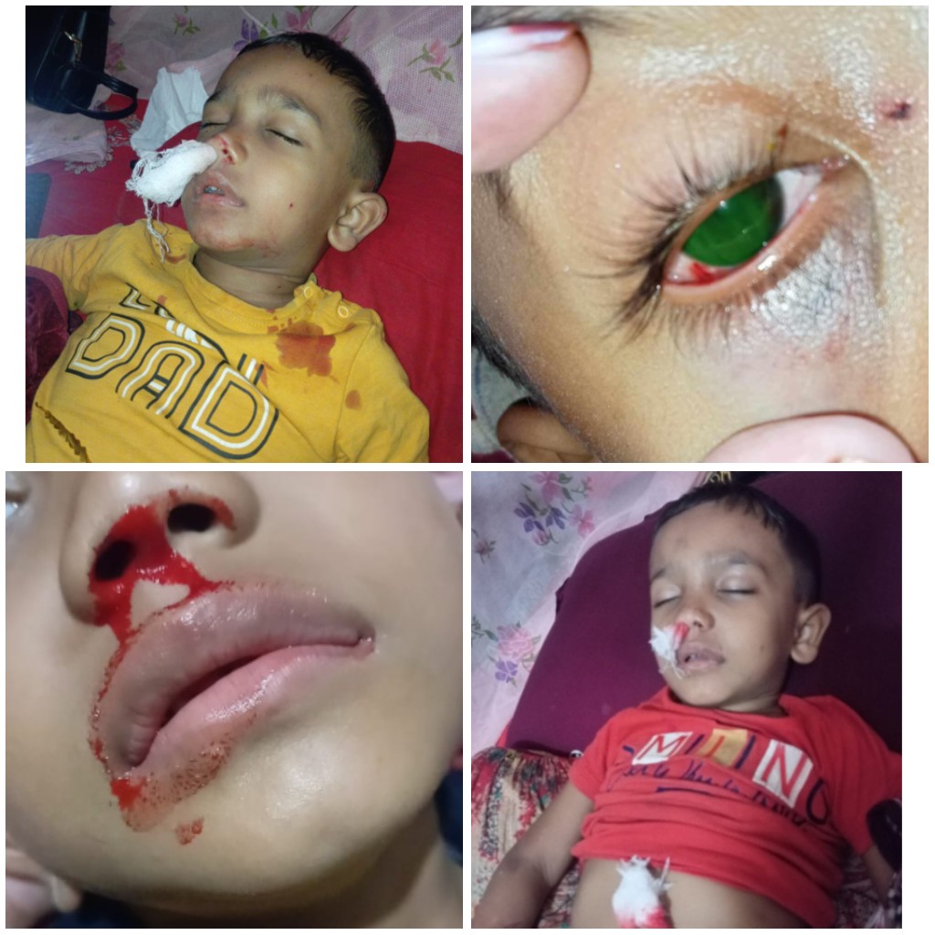 অসুস্থ সন্তানকে বাচাঁতে স্বামীর সর্বোচ্চ অবহেলা সহ্য করছেন।। শেষে বিচারের আশায় আইনের দ্বারস্থ কলাপাড়ার রীনা।।