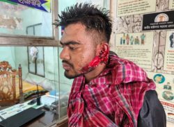 কলাপাড়ায় ভাগনি জামাতাকে কুপিয়ে হত্যা চেষ্টার অভিযোগ