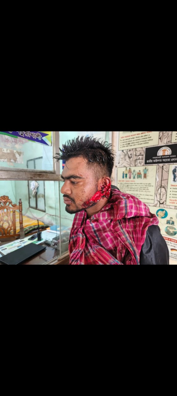 কলাপাড়ায় ভাগনি জামাতাকে কুপিয়ে হত্যা চেষ্টার অভিযোগ